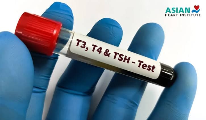 Thyroid Profile Test: Understanding TSH, T3 and T4