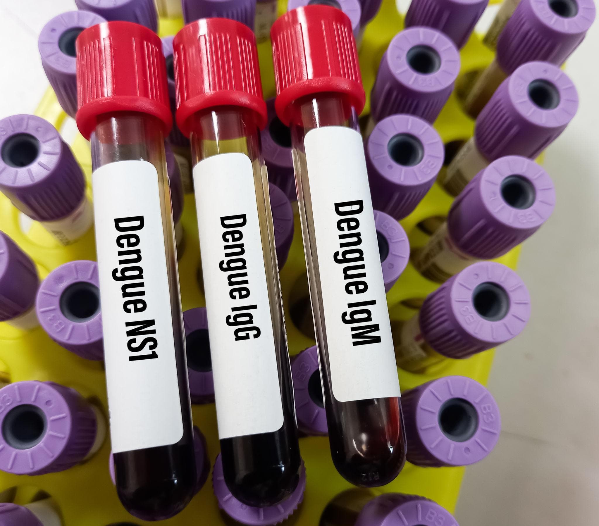 Dengue: Symptoms, Diagnosis, Treatment and Prevention