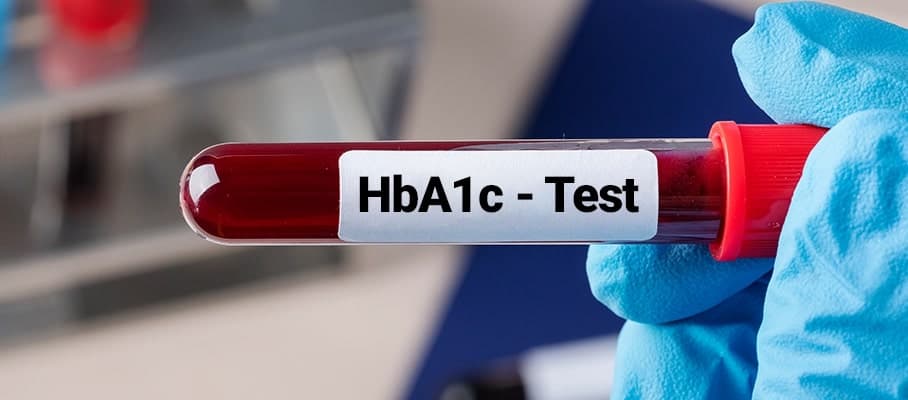 HbA1c Test: What It Measures and Why It Matters