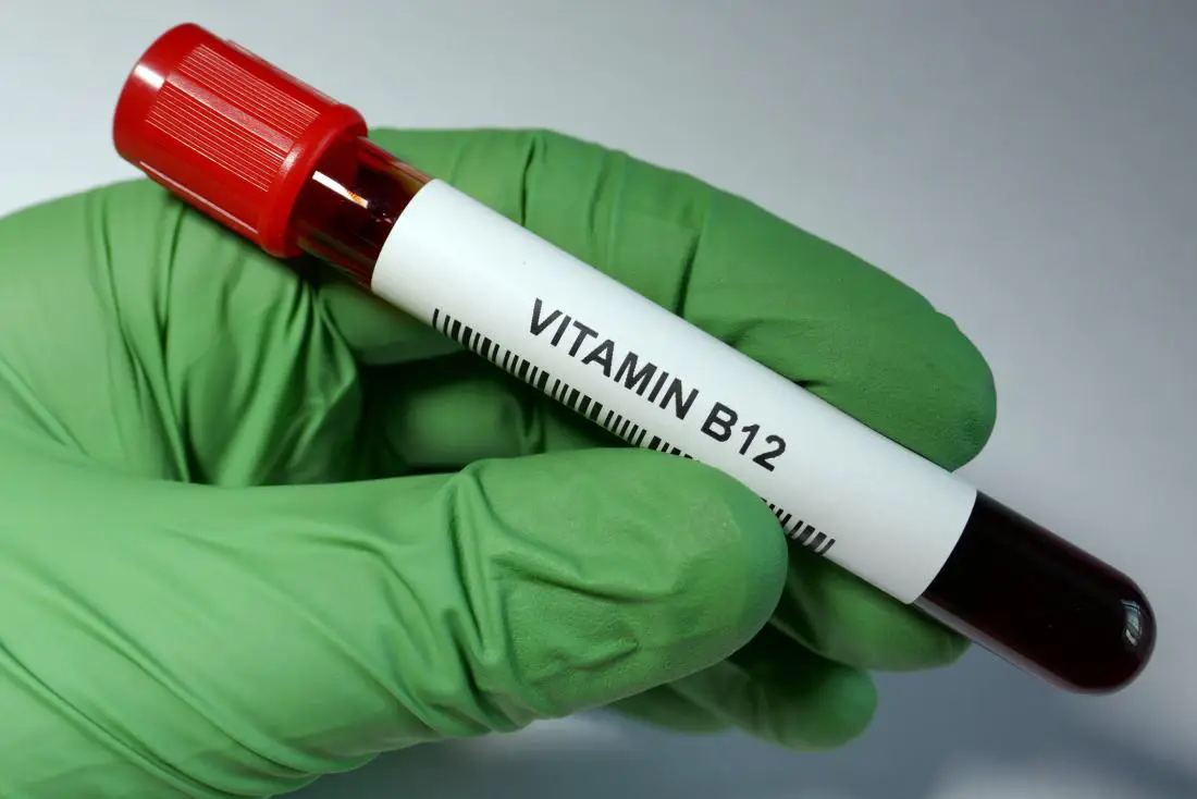 Vitamin D and Vitamin B12 Tests: When Testing May Be Recommended
