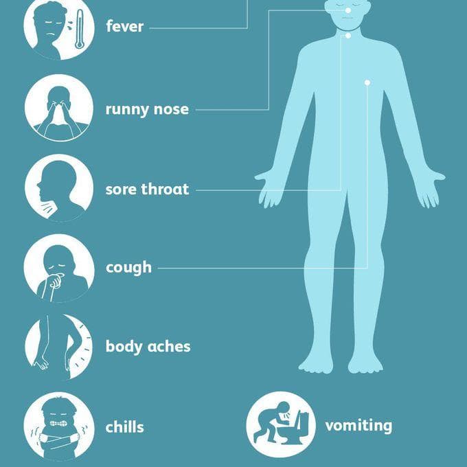 H1N1 (Swine Flu): Symptoms, Causes, Testing, Treatment & Prevention