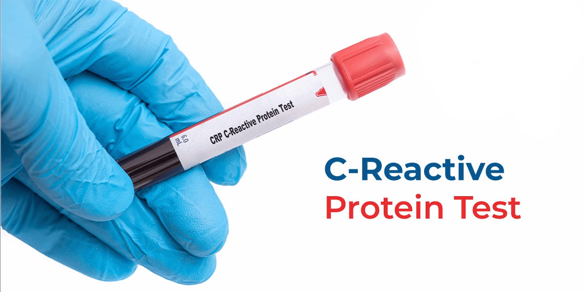 CRP TEST : WHAT IT MEANS IS IT NECESSARY